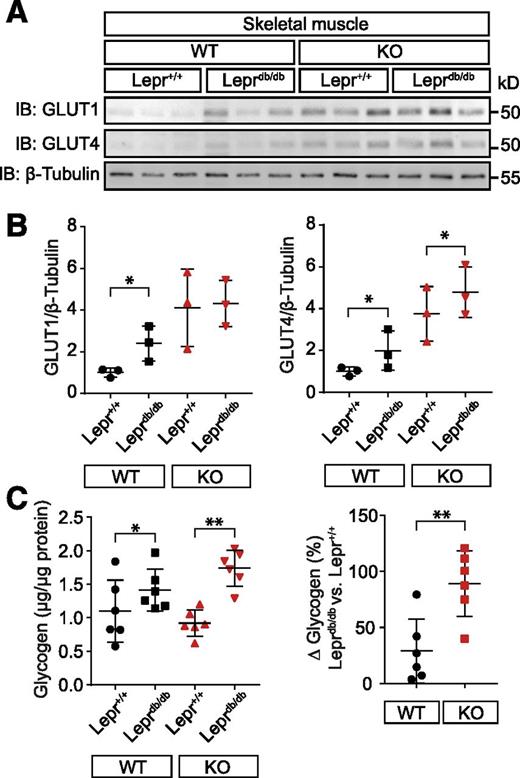 Figure 3. Evidence for increased glucose transport into skeletal muscle and for downregulated HGP in CaMKIIδ-deficient Leprdb/db mice. A: Immunoblots (IB) show levels of GLUT1 and GLUT4 in the skeletal muscle of indicated mice. B: Graphs show quantification of immunoblots, respectively, with β-tubulin used as the loading control. C: Left graph shows increased glycogen levels in skeletal muscle of both Leprdb/db/WT and Leprdb/db/KO groups compared with their nondiabetic littermates. The right graph shows increased Δglycogen content in Leprdb/db/KO mice compared with their Leprdb/db/WT littermates. Numbers of animals investigated are n = 3 in each group or depicted as symbols. All values are expressed as mean and SD. *P < 0.05, **P < 0.01, ***P < 0.001.