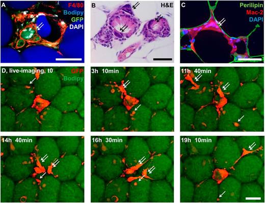 Figure 1. Occurrence and dynamics of MGCs in obese AT. A: Whole mount staining of epididymal AT of MacGreen mice after 24 weeks of an HFD. GFP and pan-macrophage marker F4/80 indicate macrophage origin. B: Hematoxylin-eosin (H&E)–stained section of epididymal AT of leptin receptor–deficient mice at 12 weeks of age. Note multiple MGCs within CLSs. C: Section of human subcutaneous AT of an obese individual stained against the macrophage marker Mac-2 (red), the adipocyte marker Perilipin (green), and the nuclear counterstain DAPI (blue). D: Representative images of a long-term live-imaging experiment on AT explants of obese MacGreen mice after 24 weeks of an HFD. Macrophages are visible because of GFP expression (red), and adipocytes were stained using the neutral lipid stain BODIPY (green). Corresponding movie is provided as Supplementary Movie 1. Arrows indicate regular ATMs; double arrows indicate MGCs. Scale bar, 50 µm.