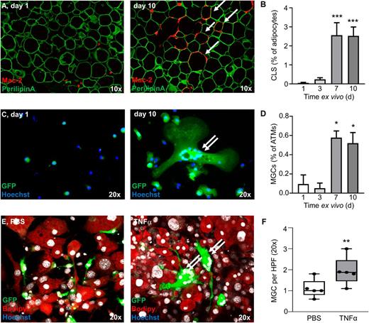 Figure 3. Adipocyte death provokes MGC formation. A: Representative images of AT explants ex vivo after days 1 and 10 of cultivation. Arrows indicate CLSs. B: Frequency of CLSs per adipocyte of AT explants ex vivo. d, day. C: Representative images of isolated stroma cells of AT explants at distinct time points of cultivation. Arrows indicate MGCs. D: Frequency of MGCs per GFP+ cells (ATMs) of AT explants ex vivo. d, day. E: Representative images of 3T3-L1 feeding experiments of GFP+ ATMs (green) and BODIPY-stained 3T3-L1 adipocytes (red), either untreated or killed by TNFα overstimulation (25 nmol/L). Double arrows indicate MGCs. F: Number of MGCs per high-power field (HPF; 20×) in coculture with dead 3T3-L1 adipocytes as a result of TNFα overstimulation (gray) or PBS-treated control (white) (n = 5). *P < 0.05, **P < 0.01, ***P < 0.001.