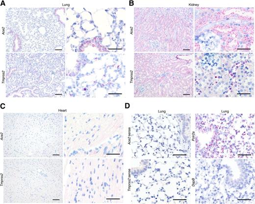 Figure 1. Site-specific localization of Ace2 and Tmprss2 in mouse lungs, kidneys, and heart using RNAscope in situ hybridization. A: Ace2 or Tmprss2 in mouse lung (left magnification ×100 [scale bars = 100 μm], right magnification ×400 [scale bars = 50 μm]). B: Ace2 or Tmprss2 in mouse kidney (left magnification ×100 [scale bars = 100 μm], right magnification ×400 [scale bars = 50 μm]). In the kidney sections, Ace2 transcripts are predominantly seen within the proximal tubule cells of the kidney cortex, which can be recognized by their taller appearance, eosinophilic cytoplasm, and brush border. Tmprss2 transcripts are most abundant in the distal convoluted tubules (flatter, paler cells) and cortical collecting ducts as well as in the transitional epithelium lining the renal papilla (evident in the top right-hand corner of the ×100 magnification image). C: Ace2 or Tmprss2 in mouse heart (left magnification ×100 [scale bars = 100 μm], right magnification ×400 [scale bars = 50 μm]). D: Sense probes for Ace2 and Tmprss2 and positive (Polr2a) and negative (bacterial transcript DapB) controls in mouse lung (magnification ×400 [scale bars = 50 μm]).