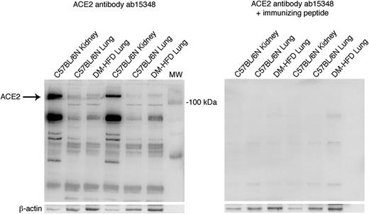 Figure 2. Specificity of the ACE2 antibody (ab15348). Western blotting of kidney and lung samples from male C57BL/6N mice (aged ∼9 weeks) and lung samples from aged, DM-HFD mice (male C57BL/6 mice fed an HFD for a total of 36 weeks and receiving an intraperitoneal injection of STZ after 15 weeks of HFD). Shown are Western blotting with the polyclonal ACE2 antibody alone (left) and Western blotting of the same samples with the polyclonal ACE2 antibody preincubated with immunizing peptide (CKGENNPGFQNTDDVQTSF) (right).