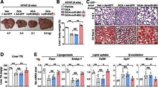 Figure 6. OCA-mediated beneficial effects on hepatosteatosis were reversed by overexpression of miR-802 in obese mice. Mice were fed an HF/HF diet for 7 weeks and then additionally infected with the Ad-miR-802, Ad-antisense–miR-802, or control virus and treated daily with OCA for 2 weeks, as indicated in Fig. 5. A: Image of liver tissues. B: Ratio of liver to body weight. C: H & E and Oil Red O staining of liver sections. D: Liver TG levels. E: Levels of the mRNAs for hepatic lipid metabolism genes determined by RT-qPCR. B, D, and E: The mean and SD are plotted. Statistical significance was determined by one-way ANOVA (n = 5). *P < 0.05, **P < 0.01. Ad, adenovirus; H & E, hematoxylin and eosin; HF/HF, high fat/high fructose; TG, triglyceride; Veh, vehicle.