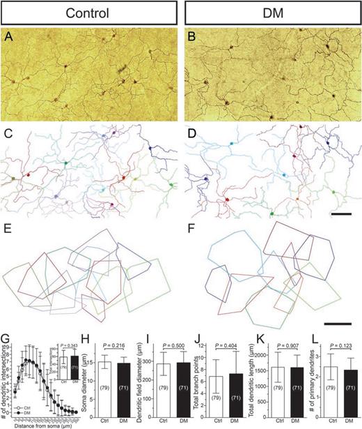 Figure 2. DM did not cause morphological changes in M1 ipRGCs. A and B: Representative areas of whole-mount retinas stained with PA1-780 melanopsin antibody using immunoperoxidase method in control and DM mice. Focal planes lie in the outermost level of the IPL to reveal the dendritic network of M1 ipRGCs. C and D: Reconstructed mosaic comprising all M1 cells in the areas shown in A and B. E and F: Dendritic field areas of each fully reconstructed M1 cell in C and D indicated as minimal polygons. G: Sholl analysis of M1 cells from control and DM mice revealed no significant changes in dendritic complexity. Inset is a bar graph comparing the total number of intersections between groups. H–L: No significant difference was detected in any major soma-dendritic parameters between control and DM mice. Sample sizes are given in parentheses. Scale bars = 200 μm. Ctrl, control.