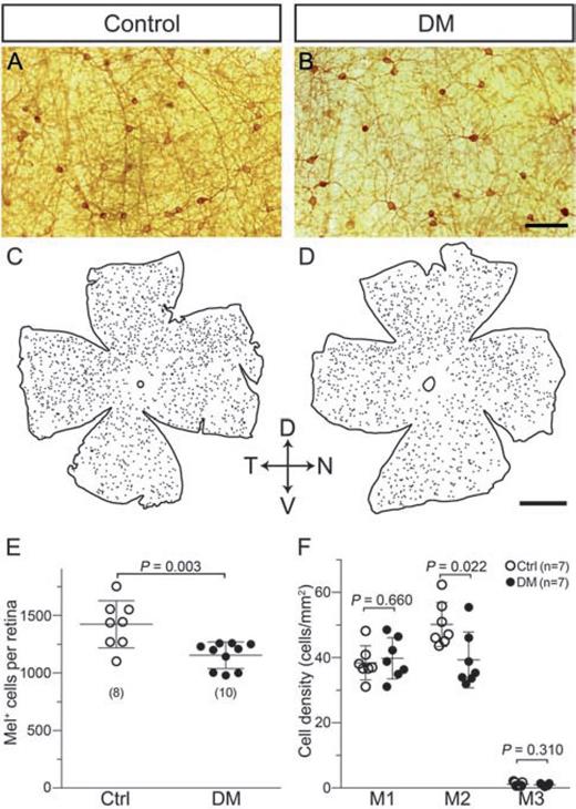 Figure 3. DM caused loss of M2 ipRGCs. A and B: Representative photomicrographs captured from a small area within whole-mount retinas in the control and DM groups, which were stained by enhanced immunohistochemistry with a melanopsin antibody (UF006) labeling both M1 and non-M1 ipRGCs. C and D: Distribution maps of melanopsin-positive (Mel+) cells shown in A and B; each dot represents a melanopsin-immunoreactive soma. E: Counting of whole-retina cells positive for UF006 melanopsin antibody revealed a significant decline among DM mice. F: A comparison of density of M1, M2, and M3 cells, distinguished by distinct stratification patterns in the IPL, between control and DM mice. DM significantly reduced M2 cell density but did not cause M1 or M3 cell loss. Sample sizes are given in parentheses. Scale bars = 100 μm in B and 1 mm in D. Ctrl, control; D, dorsal; N, nasal; T, temporal; V, ventral.