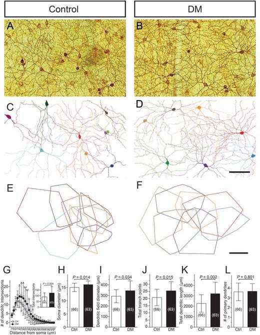 Figure 4. DM severely changed soma-dendritic profiles of M2 ipRGCs. A and B: Representative areas of whole-mount retinas stained with UF006 melanopsin antibody using immunoperoxidase method in control and DM mice. Focal planes lie in the inner part of the IPL, where the dendritic networks of M2 ipRGCs reside. C and D: Reconstruction of the mosaic comprising all M2 cells in the areas shown in panels A and B. E and F: Dendritic field areas of each fully reconstructed M2 cell in C and D, indicated as minimal polygons. G: Sholl analysis revealed a significant increase in the number of dendritic intersections in multiple dendritic regions, indicating enhanced dendritic branching. Inset is a bar graph comparing the total number of intersections between the two groups. H–L: Bar graphs comparing major soma-dendritic parameters between control and DM mice. Soma swelling (H), dendritic field enlargement (I), increased total branch points (K), and increased dendritic length (L) were detected in DM mice. Sample sizes are given in parentheses. Scale bars = 100 μm. *P < 0.05, **P < 0.01. Ctrl, control.