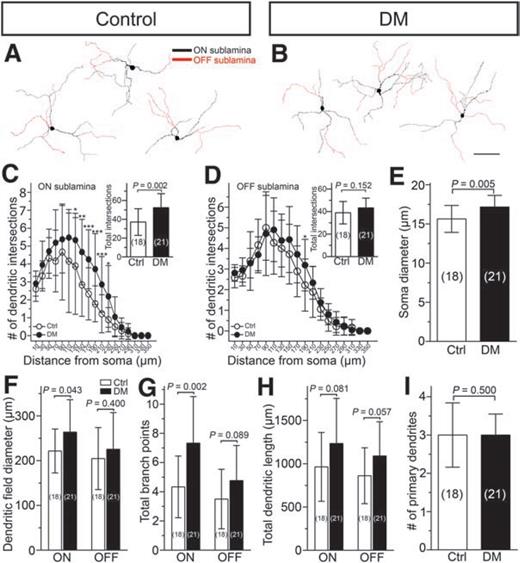 Figure 5. DM differentially affected ON and OFF sublayer dendritic arbors of M3 ipRGCs. A and B: Representative examples of soma-dendritic profiles of M3 cells in control and DM mice reconstructed from whole-mount retinas stained with UF006 melanopsin antibody using immunoperoxidase method. C and D: Sholl analysis of ON and OFF sublayer dendritic arbors of M3 cells. DM significantly increased the number of dendritic intersections in multiple regions of ON arbors but only did so at 190 μm from the soma of OFF arbors. Insets are bar graphs comparing the total number of intersections between groups. E–I: Bar graphs comparing major soma-dendritic parameters between control and DM mice. Soma swelling (E), dendritic field enlargement (F), and increased total branch points (G) of ON sublayer arbors were observed in DM mice. Sample sizes are given in parentheses. Scale bars = 100 μm. *P < 0.05, **P < 0.01, ***P < 0.001. Ctrl, control.
