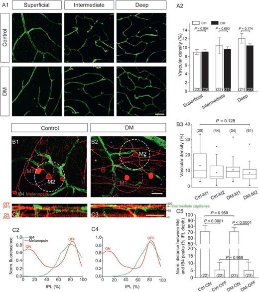 Figure 8. Cell-subtype-specific spatial relationship between ipRGC dendritic arbors and retinal capillaries. A1: Representative photomicrographs of IB4 staining in control and DM retinas, revealing three (superficial, intermediate, and deep) capillary plexuses. A2: Bar graphs showing that the overall vascular density, determined by measuring IB4-positive area, was not changed by DM in any of the three capillary plexuses. B1 and B2: Representative collapsed confocal stacks of whole-mount retinas double-stained with UF006 melanopsin antibody and IB4 from control and DM mice, showing the spatial relationship between somata of M1/M2 cells (identified by differentially stratified dendrites) and the superficial capillary plexus. B3: The density of capillaries surrounding individual ipRGCs, calculated by measuring IB4-positive area size in an 83-μm diameter region centered at each soma (dashed circles in B1 and B2), is similar among all four experimental groups. C1 and C3: Digitally rotated side views of representative confocal z-stacks showing ON (inner) and OFF (outer) melanopsin-positive plexuses in relation to IB4-labeled intermediate capillary plexus. Numbers denote relative depth of the IPL (GCL = 0, inner nuclear layer = 100). C2 and C4: Fluorescence intensity profiles, averaged from dozens of images as C1 and C3, of melanopsin and IB4 signals versus normalized (Norm.) depth of the IPL. C5: Bar graph showing that the average distance between fluorescence peaks of OFF melanopsin plexus and IB4 plexus is much shorter than ON melanopsin–IB4 peak distance in both control and DM retinas; for both of the two distances, the DM group is not different from control. Scale bars = 40 μm in A1 and 30 μm in B2 and C3. Sample sizes are given in parentheses. Ctrl, control; Mel, melanopsin.