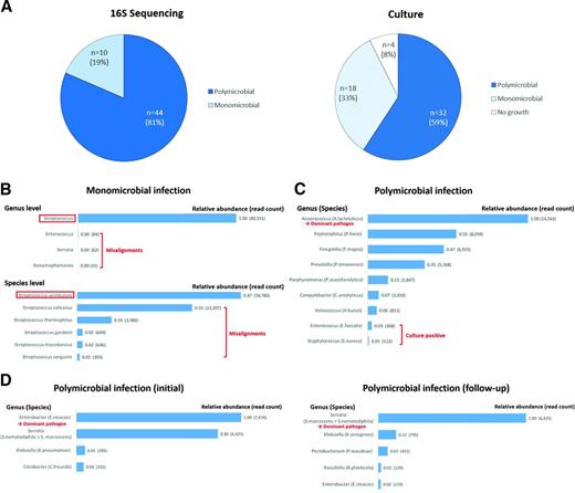 Figure 1. The proportion of monomicrobial and polymicrobial infections, and illustrative cases of 16S sequencing. A: According to 16S sequencing, 81% (44 of 54) of the cases were polymicrobial infections. Meanwhile, conventional culture studies identified polymicrobial infections in only 59% (32 of 54) of the cases. Monomicrobial infection was suggested in 33% (18 of 54) of cases, and no bacteria were isolated in 4 cases. Twelve cases of polymicrobial infections were misdiagnosed as monomicrobial infections (n = 10) or no growth (n = 2). B: An illustrative case of monomicrobial infection (patient 40). Genus-level alignment of the reads revealed a Streptococcus monomicrobial infection. Other genera listed are the result of misalignment. On a species-level alignment, S. vestibularis was at the top of the list and considered to be the pathogen. C: An illustrative case of polymicrobial infection (patient 13). After read alignment to the 16S database, Anaerococcus had the largest number of reads and thus was considered to be the dominant pathogen. In the species-level analysis, A. lactolyticus was suggested since it was the top ranked among the Anaerococcus species. In addition to Anaerococcus, Peptoniphilus (P. harei), Finegoldia (F. magna), Prevotella (P. timonensis), and others were present in the sample. Enterococcus (E. faecalis) and Staphylococcus (S. aureus) were isolated by the culture studies in this sample; however, they were ranked eighth and ninth in the 16S sequencing analysis. D: An illustrative case of follow-up study in polymicrobial infection (patient 8). On the initial 16S sequencing (case 10), Enterobacter (E. cloacae) was found to be the most abundant in the sample, followed by Serratia, Klebsiella, and Citrobacter. In the follow-up 16S sequencing (case 33), performed after a 4-week antibiotic treatment, Serratia was the most abundant pathogen in the samples. This reflects that Enterobacter was successfully treated by the antibiotics but that Serratia was resistant to the treatment.
