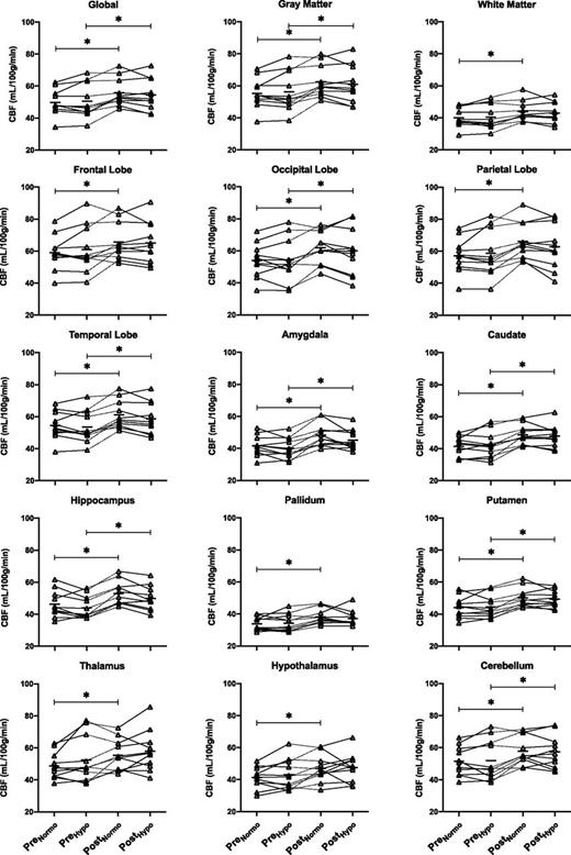 Figure 5. Regional CBF (by ASL) for normo- and hypoglycemia states in subjects pre- and postsurgery. Data are presented as spaghetti plots of individual values with individual connecting lines and mean of all subjects at that time point (horizontal solid lines). *P < 0.05 (paired t tests, n = 11). hypo, hypoglycemic phase of clamp; normo, normoglycemic phase of clamp; Pre, preoperative; Post, postoperative.