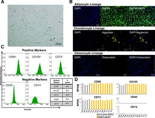 Figure 1. MSC phenotype and characterization. A: Adipose tissue-derived MSC harvested from participants with DKD show typical morphological appearance under the microscope as spindle-shaped, fibroblast-like cells in culture. B: Trilineage differentiation into adipocyte (FABP4, positive staining represents adipocytes), chondrocyte (aggrecan, positive staining represents chondrocytes), and osteocyte (osteocalcin, positive staining represents osteocytes) lineages is achieved in DKD-MSC. C: Cell surface markers characteristic of MSC positivity to CD90, CD105, and CD73 and negativity to CD45 and CD14 are expressed in DKD-MSC through flow cytometric analysis. D: In concordance, gene expression of MSC surface markers is similarly expressed both in Control-MSC and DKD-MSC. RPKM, reads per kilobase million reads.