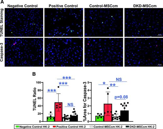Figure 5. MSC antiapoptotic activity. Apoptosis activity was assessed in HG + TGF-β1–exposed HK-2 cells exposed to MSCcm. A and B: Proapoptotic markers TUNEL and caspase-3 staining was reduced in DKD-injured HK-2 after treatment with DKD-MSCcm (P < 0.0001 and P = 0.2, respectively) and Control-MSCcm (P < 0.0001 and P = 0.002, respectively). Control-MSCcm trended toward greater reduction of caspase-3 immunostaining vs. DKD-MSCcm (P = 0.08) but was not different for TUNEL (P = 0.7). Negative control, n = 5; positive control, n = 5; control-MSCcm, n = 10; DKD-MSCcm, n = 13. *P < 0.05, **P ≤ 0.01, ***P ≤ 0.001.