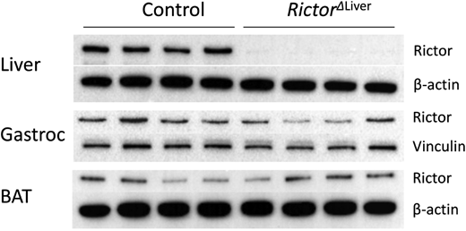 Western blot analysis showing liver-specific knockout of the protein RICTOR in mice. BAT, brown adipose tissue; Gastroc, gastrocnemius.
