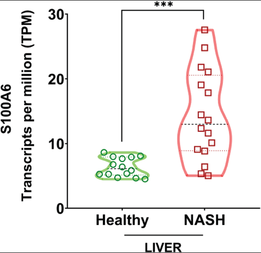 S100A6 transcript abundance in livers of healthy individuals and patients with NASH.