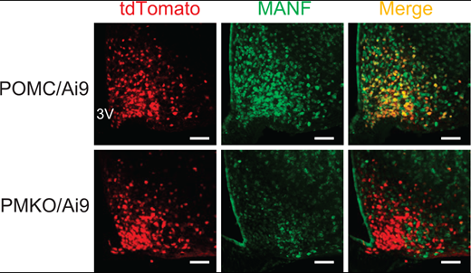 Immunofluorescence staining of MANF (green) in POMC neurons (red) and merge (yellow) in control mice (POMC/Ai9) and MANF knockout (PMKO/Ai9) mice.