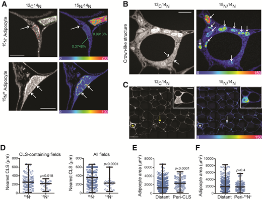 New adipocytes arise near dead adipocytes. A: Top: Representative MIMS image of [15N]thymidine unlabeled adipocyte. Two regions of interest are indicated, one for the adipocyte nucleus and the second for a 15N-labeled interstitial cell. The corresponding 15N percentage is shown. The unlabeled nucleus is at natural abundance. The arrow denotes small nondominant lipid droplets, which are commonly observed in the perinuclear region of adipocytes adjacent to the dominant lipid droplet. Bottom: Representative 15N-labeled adipocyte. Scale = 5 μm. B: MIMS images of representative CLS. Scale = 10 μm. C: Mosaic images where adjacent imaging fields are stitched together. Left: 12C14N image shows histological features. Right: Hue saturation intensity ratio image reveals [15N]thymidine labeling. *CLS. Arrow: [15N]thymidine labeled multilocular immature adipocyte near CLS, also shown in the inset. Scale = 50 μm. Inset scale = 5 μm. D: Proximity of [15N]thymidine unlabeled and [15N]thymidine labeled adipocytes to the nearest CLS. Left: Only adipocyte nuclei in mosaics that contained a CLS are included. Right: All imaged fields are included, with non-CLS fields using distance to image border as proxy for distance to nearest CLS. E: Adipocyte cross-sectional area of adipocytes immediately adjacent to a CLS (Peri-CLS) relative to cross-sectional areas of nonadjacent adipocytes (Distant). F: Adipocyte cross-sectional area of adipocytes immediately adjacent to a [15N]thymidine labeled adipocyte (Peri-15N+) relative to cross-sectional areas of nonadjacent adipocytes (Distant). In C–E data are shown as dot plots with median +/− max/min.