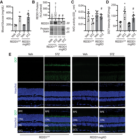 Müller cell–specific REDD1 deletion prevented diabetes-induced Nrf2 suppression and attenuated oxidative stress in the retina. Diabetes was induced in REDD1fl/fl and REDD1-mgKO mice by administration of STZ. Control mice received a vehicle (Veh). All retinal analysis was performed after 6 weeks of diabetes. A: Postprandial blood glucose concentrations were measured. B: REDD1 protein expression was evaluated in retinal lysates by Western blotting. Protein loading was evaluated by reversible protein stain. Blots shown are representative of two independent experiments. Protein molecular mass (kDa) is indicated at right of blots. C: Nrf2 activity was evaluated in the nuclear fraction obtained from retinal lysates of REDD1fl/fl and REDD1-mgKO mice by DNA-binding ELISA. OD, optical density. D: ROS were quantified in the supernatants from whole retinal lysates using DCF. Values are means ± SD (n = 5–9). RFU, relative fluorescent units. Significance was defined as P < 0.05 for all analyses. *P ≤ 0.05 vs. Veh; #P ≤ 0.05 vs. REDD1fl/fl. E: ROS were visualized in whole-eye sagittal cross-sections using DCF. Hoechst was used to visualize nuclei. GCL, ganglion cell layer; INL, inner nuclear layer; ONL, outer nuclear layer; RPE, retinal pigment epithelium.