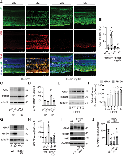 REDD1 was necessary for GFAP upregulation in response to diabetes or hyperglycemic conditions. A and B: Diabetes was induced in REDD1fl/fl and REDD1-mgKO mice by administration of STZ. All analyses were performed 6 weeks after mice were administered STZ or a vehicle (Veh). Whole eyes were isolated and sectioned. GFAP and GS were evaluated in retinal cross-sections by immunofluorescence. Hoechst was used to visualize nuclei. GCL, ganglion cell layer; INL, inner nuclear layer; ONL, outer nuclear layer. B: Quantification of GFAP protein expression in retinal sections. RFU, relative fluorescent units. C: Human MIO-M1 cells were cultured in medium containing 5 mmol/L glucose and exposed to culture medium containing 30 mmol/L glucose (HG) or 5 mmol/L glucose and 25 mmol/L mannitol as an osmotic control (OC) in the presence of NAC or a vehicle (Veh) control for 4 h. Whole-cell lysates were analyzed by Western blotting. Protein molecular mass (kDa) is indicated at the right of blots. D: GFAP protein expression in C was quantified. E: MIO-M1 cells were exposed to medium supplemented with 1 mmol/L hydrogen peroxide (HP). F: GFAP and REDD1 protein expression in E were quantified. G: Wild-type (WT) and REDD1-KO MIO-M1 cells were exposed to OC or HG as described above. H: GFAP protein expression in G was quantified. I and J: Nrf2 was knocked down by stable expression of a shRNA (shNrf2). Control cells expressed a scramble shRNA (shScram). All analysis was performed 4 h after exposure to medium containing 30 mmol/L glucose. Bars are means ± SD (n = 4–9). *P ≤ 0.05 vs. Veh, time 0, or WT in B and D, F, and H, respectively; #P ≤ 0.05 vs. REDD1fl/fl or OC in B and H, respectively; $P ≤ 0.05 vs. shScram.