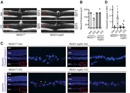 Retinal thinning was not observed in diabetic mice with Müller cell–specific REDD1 deletion. Diabetes was induced in REDD1fl/fl and REDD1-mgKO mice by administration of STZ. Control mice received a vehicle (Veh). All retinal analysis was performed after 6 weeks of diabetes. A: Retinal thickness was evaluated by SD-OCT. Representative images are shown. B: Retinal thickness from the RNFL to the photoreceptor OS was manually measured as indicated by red calipers. C: Whole eyes were isolated and cryosectioned into sagittally oriented longitudinal cross-sections, and cleaved caspase-3 was evaluated by immunohistochemistry. The red box indicates the area presented at higher magnification. White arrowheads indicate cleaved caspase-3–positive immunoreactivity. D: Cleaved caspase-3 intensity was quantified in retinal cross-sections. Bars are means ± SD (n = 5–7). *P ≤ 0.05 vs. Veh; #P ≤ 0.05 vs REDD1fl/fl. INL, inner nuclear layer; ONL, outer nuclear layer; RPE, retinal pigment epithelium; RFI, relative fluorescent intensity.