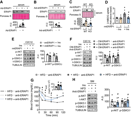 ERAP1 acts as a hepatokine that impairs SM insulin (Ins) sensitivity. (A−C) ERAP1 levels in serum by Western blotting (top) and quantified by densitometric analysis (bottom). (D) 2-NBDG uptake in C2C12 myotubes. (E, F, and H) p-AKT, t-AKT, p-GSK3β, and t-GSK3β levels by Western blotting before or after Ins stimulation (left) and quantified by densitometric analysis of the relative abundance of phosphorylated protein normalized to their total protein levels (right). (G) ITTs. Studies were conducted using 10-week-old, male, WT mice injected with − Ad-ERAP1 or + Ad-ERAP1 (A), or injected with − Ad-shERAP1 or + Ad-shERAP1 (B). (C) Studies were conducted using 10-week-old, male, global Erap1 KO mice injected with − Ad-ERAP1 or + Ad-ERAP1. (D and E) C2C12 myotubes were incubated with (+ rmERAP1) or without (− rmERAP1) 500 ng/mL rmERAP1 for 20 min and stimulated with or without 100 nmol/L Ins for 20 min at the same time. (F) C2C12 myotubes were incubated with control conditioned medium (− CM-ERAP1) or high ERAP1 conditioned medium (+ CM-ERAP1) for 48 h and incubated with (+ anti-ERAP1) or without (− anti-ERAP1) 12 μg/mL anti-ERAP1 antibodies at the last 12 h and stimulated with 100 nmol/L Ins for 20 min. (G and H) Studies were conducted using 4-week-old, male, WT mice fed a control diet (− HFD) or + HFD for 16 weeks and then intraperitoneally injected with 1 mg/kg anti-IgG antibodies (− anti-ERAP1) or anti-ERAP1 antibodies (+ anti-ERAP1). Data are expressed as the mean ± SEM (n = 5–7 per group, as indicated), with individual data points. *P < 0.05 for the effect of any group vs. control group; #P < 0.05 for + rmERAP1 vs. – rmERAP1 under + Ins conditions (D), or + anti-ERAP1 vs. − anti-ERAP1 under + CM-ERAP1 or + HFD conditions in (F−H). A.U., arbitrary unit; AUC, area under the curve.