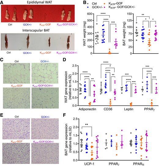 Adipose tissue mass and function are improved in diabetic mice with reduced β-cell GCK. A: Representative images of epididymal/gonadal WAT and interscapular BAT. B: Quantification epididymal WAT and interscapular BAT (n = 8–15 mice/group). C and E: Representative images of paraffin sections of H-E–stained WAT and BAT. D and F: Quantitative real-time PCR analysis of adiponectin, CD36, leptin, and PPARγ for WAT or UCP-1, PPARγ, and PPARα for BAT (n = 4–13 mice/group). Data are mean ± SEM. *P < 0.05, **P < 0.01, ***P < 0.001, ****P < 0.0001. Nonsignificant differences are not shown. Ctrl, control.
