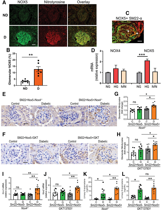 Upregulation of NOX5 in human DKD and overexpression of NOX5 enhances renal and urinary ROS independent of NOX4 in diabetic mice. A: Immunostaining of NOX5 and marker of ROS, nitrotyrosine, and their colocalization in human kidney biopsy specimens obtained from nondiabetic (ND) individuals and patients with diabetes (D). B: Quantitation of human glomerular NOX5 in ND and D individuals (n = 6 per group). C: Colocalization of NOX5 and SM22-α (a marker of SMCs or mesangial cells; yellow staining indicated by arrow) in a human kidney biopsy specimen of patient with diabetes. Scale bar, 50 μm for human kidney biopsy specimens in all photomicrographs. D: Gene expression of NOX4 and NOX5 in human mesangial cells exposed to normal glucose levels (NG; 5 mmol/L), high glucose levels (HG; 25 mmol/L), and NG plus mannitol (MN; 20 mmol/L; an osmotic control). Immunostaining of nitrotyrosine (E and F); the quantitation in the glomeruli (G and H); renal cortical gene expression of Nox2 (I and J); and the level of urinary 8-isoprostane (K and L) in Nox4 knockout (Nox4−/−) or GKT137831-treated mice with and without NOX5 expression after 10 weeks of STZ-diabetes. Scale bar, 20 μm in all photomicrographs. Data are shown as mean ± SEM (n = 7–10/group). *P < 0.05, **P < 0.01, ***P <0.001. C, control; D, diabetic; ns, not significant statistically.
