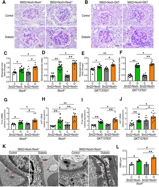NOX5 overexpression aggravates glomerulosclerosis and thickening of GBM in DKD independent of NOX4. Periodic acid-Schiff staining (A and B), relative mesangial area expansion (C and E), and GSI (D and F), as well as renal cortical gene expression of Pcna (G and I) and Ki67 (H and J) in all groups of Nox4 KO (Nox4−/−) mice with and without NOX5 expression or in GKT137831-treated mice with and without NOX5 expression after 10 weeks of STZ-diabetes. Scale bar, 20 μm in all photomicrographs (n = 8–10/group). K and L: Transmission electron micrographs showing GBM thickness (n = 3/group; scale bar, 0.5 μm). Data are shown as mean ± SEM. *P < 0.05, **P < 0.01. C, control; D, diabetic.