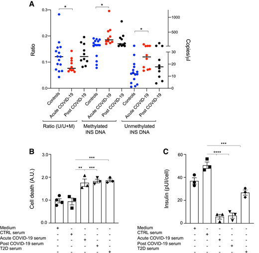 In vivo and in vitro evidence of cell death associated with COVID-19. A: Comparison of the ratio of unmethylated (U) INS DNA/U plus methylated (M) INS DNA was performed in patients with COVID-19 (acute COVID-19), in patients who had recovered from COVID-19 (post COVID-19), and in healthy control subjects. Ratio of 0.196 was considered as a cutoff (mean plus 2SD; 97.7th percentile) for the U/M+U calculation, with a ratio ≥0.196 indicating β-cell death. Comparison of the levels of U INS DNA as well as of M INS DNA (i.e., copies of U/μL and copies of M INS DNA/μL) was performed and measured by droplet digital PCR in serum samples from patients with COVID-19 (acute COVID-19 and post COVID-19) and in healthy control subjects. B and C: Rates of cell death and insulin secretion were analyzed for purified human islets upon in vitro challenge with serum from healthy control subjects, from patients with COVID-19 (acute COVID-19), from patients who had recovered from COVID-19 (post COVID-19), or from patients with type 2 diabetes (T2D). Data are representative of n = 15 samples from the subgroup of healthy control subjects and n = 10 from acute COVID-19 and from post COVID-19. Data are representative of a pool of n = 3–4 commercial islet preparations in three separate experiments (n = 3–5 pooled sera tested). Data are represented as mean ± SEM. Ordinary one-way ANOVA test with Bonferroni correction was used for calculating statistical significance between all groups. *P < 0.05, **P < 0.01, ***P < 0.001, ****P < 0.0001. AU, arbitrary unit.