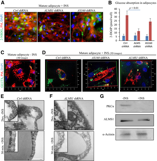 ALMS1 is required for GLUT4 sorting vesicles fusion with the PM upon INS signaling. A: Photographs showing cellular uptake of glucose analog 2-NBDG (in green) in human adipocytes upon 30 min INS stimulation. Scale bar: 10 μm. B: Quantification of glucose analog 2-deoxy-glucose-6-phosphate (2-DG6P) cellular uptake in adipocytes (n = 8 wells per group). Blue, vehicle; red, PATAS. C: 3D images of nonpermeabilized, fixed mature adipocytes cultured without INS depicting membrane-bound GLUT4 (in green). PM was stained with Image-iT (in red). D: 3D images of nonpermeabilized, fixed, mature adipocytes cultured with INS depicting membrane-bound GLUT4 with the indicated shRNA treatment. TEM of control (Ctrl) adipocytes (left and right panels) (E) and of ALMS1-silenced adipocytes (left and right panels) (F) under the same conditions. Scale bar: 500 nm. G: Immunodetection of PKCα, ALMS1, and α-actinin in immunoprecipitates using ALMS1 as bait in adipocytes cell lysates cultured in absence or presence of INS.