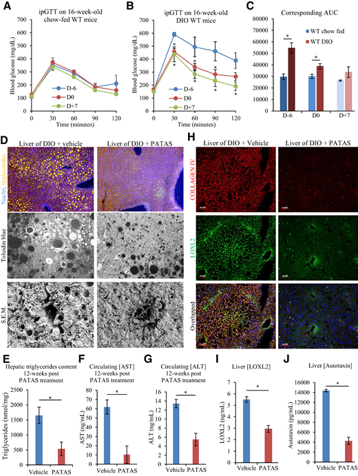 PATAS improves glucose intolerance and liver function up to 3 months posttreatment in DIO mice. A: Blood glucose excursion curve during ipGTT 6 days before PATAS injection (D−6), on the day of PATAS injection (D0), and 7 days post-PATAS injection (D+7) on the same chow-fed mice. PATAS dosing was 2 mg/kg BW (n = 8 mice). B: Blood glucose excursion curve during ipGTT 6 days before PATAS injection (D−6), on the day of PATAS injection (D0) and 7 days post-PATAS injection (D+7) on the same high fat–/high glucose–fed DIO mice. PATAS dosing was 2 mg/kg BW (n = 8 mice). *P < 0.05. C: Corresponding AUC for A and B. D: Representative photographs of hepatic lipid droplets in AdipoRed-stained liver cryosections (top panels), in Toluidine-blue stained semithick sections (bottom panel), and scanning electron microscopy (S.E.M.) photographs depicting empty egg shell-like structure corresponding to lipid droplet (bottom panel) from 6-month-old DIO male mice that received for 1 month a weekly injection of PATAS, followed by a 12-week post-PATAS treatment. Scale bar: 100 μm. E: Quantitative determination of hepatic TGs content for the indicated treatment groups in the DIO mice. *P < 0.05. Corresponding circulating levels of liver enzymes AST (F) and ALT (G) levels with a significant decrease in the PATAS-treated mice (n = 8 mice per group). *P < 0.05. H: Representative photographs of immunostained liver cryosections for collagen IV (in red) and LOXL2 (in green) depict a decrease in both fibrotic markers in response to PATAS administration. ELISA quantification of hepatic LOXL2 (I) and autotaxin (ATX) (J) in saline vehicle vs. PATAS group (n = 8 mice per group). *P < 0.05. Scale bar: 50 μm.