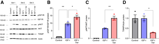 Verapamil promotes IGF-I signaling. A: INS-1 cells were treated with or without 100 μmol/L verapamil for 24 h followed by 30 min exposure to 5 nmol/L IGF-I, and pIGF1R, total IGF1R, pAKT, total AKT, TXIP, and actin protein levels were assessed by Western blotting. B and C: Effects on IGF1R phosphorylation/activation were assessed by quantifying band intensities of pIGF1R corrected for total IGF1R and of pAKT corrected for total AKT. D: Effects on TXNIP expression were assessed by quantifying band intensities of TXNIP normalized to actin. Data are mean ± SEM of three independent experiments. *P < 0.05, **P < 0.01. Ver, verapamil.