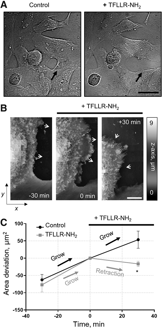 PAR1-mediated remodeling of podocyte structures. A: Representative light microscopy imaging of PAR1-mediated remodeling of tight junctions in cultured human podocytes after TFLLR-NH2 (20 μmol/L) application. Scale bar is 50 µm. B: Effect of PAR1 receptor agonist TFLLR-NH2 on podocyte structures assessed with SICM. An example of podocyte lamellipodia before and after application of TFLLR-NH2 (20 μmol/L). The arrows show the direction of lamellipodium changes over time. Scale bar is 5 µm. C: Summary graph demonstrating that activation of PAR1 signaling promotes retraction of podocyte lamellipodium. Data are shown as a cell area deviation normalized to the time of TFLLR-NH2 application (0 min). The graph demonstrates significant retraction of the lamellipodium and a significant decrease in cell surface area (n = 5, t test, P < 0.05). The arrows show the direction of lamellipodium changes over time.