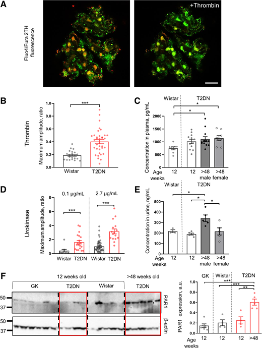 Acute serine protease application promotes activation of intracellular calcium in T2DN rat glomerular podocytes. A: The representative confocal imaging showed an application of thrombin (10 μmol/L) and a corresponding elevation of intracellular calcium (3 min between images) indicated as the ratio of Fluo-4 (green) and Fura 2TH (red) fluorescent dyes. Scale bar is 20 μmol/L. B: Summary of the [Ca2+]i amplitudes in response to thrombin in Wistar and T2DN rats (n ≥ 21, ***P < 0.001). C: Thrombin concentration in plasma of young Wistar (n = 8) and T2DN (n = 12) rats, and >48-week-old T2DN male (n = 12) and female (n = 8) rats (ANOVA, *P < 0.05). D: Summary of the [Ca2+]i amplitudes in response to different concentrations of urokinase in Wistar and T2DN rats (0.1 μg/mL, Wistar n = 10 vs. T2DN n = 20 cells, t test, ***P < 0.001; 2.7 μg/mL, Wistar n = 51 vs. T2DN n = 16 cells, t test, ***P < 0.001). E: Urokinase concentration in urine of 12-week-old Wistar and 12- and 48-week-old male and 48-week-old female T2DN rats (ANOVA, *P < 0.05). F: Western blot analysis of PAR1 expression in GK (n = 6), Wistar (n = 4), and young (n = 4) and old (n = 5) T2DN rats. Each band represents a fraction of freshly isolated glomeruli from one rat. Data are mean ± SEM, ANOVA, **P < 0.01, ***P < 0.001; a.u. arbitrary units.