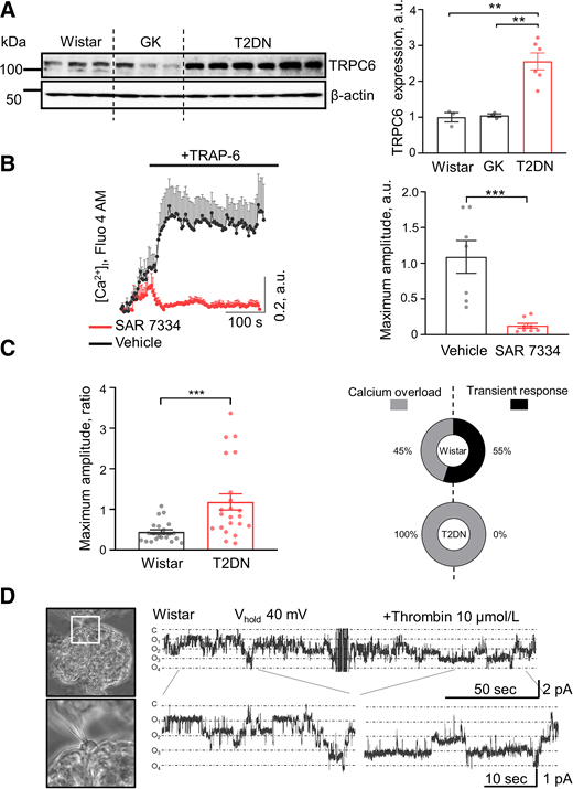 PAR-mediated TRPC6 activation. A: The progression of DN in T2DN rats (>48 weeks old) strongly correlates with increased TRPC6 expression (Wistar n = 3 vs. GK n = 3 vs. T2DN n = 6; mean ± SEM, ANOVA, **P < 0.01); a.u., arbitrary units. B: Changes in [Ca2+]i in podocytes of freshly isolated glomeruli activated by acute application of selective PAR1 agonist TRAP-6 (10 μmol/L) after 10 min of preincubation with vehicle (DMSO; black) or TRPC6 blocker (20 μmol/L, SAR7334; red). The summary shows changes in maximum fluorescence amplitude (Fluo-4 AM) in response to PAR1 activation rat freshly isolated glomeruli (n ≥ 7, t test, ***P < 0.001). C: The maximum amplitude ratio of [Ca2+]i response in the podocyte of the freshly isolated glomerulus after PAR1 activation by TRAP-6 (10 μmol/L) was significantly higher in T2DN rats compared with Wistar (n ≥ 22, t test, ***P < 0.001). In Wistar rats, both fast and slow calcium responses were observed (55% vs. 45%, respectively), but, in T2DN rats, only a slow, sustained response was present. D: Thrombin activates TRPC-like channels in the podocytes of the freshly isolated rat glomeruli from the Wistar rat. Microphotograph of the patch clamp experiment on the podocyte of the freshly isolated glomerulus (the white rectangle highlights the specified area shown on the photo below, showcasing the details of the patch-clamp procedure on the podocyte) and representative current trace from a cell. The application of thrombin (10 μmol/L) promoted a transient increase in channel activity. The close state is indicated as “c,” and the open state is indicated as “o.”