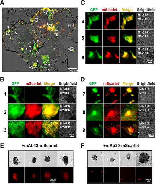 Distribution of mAb43-mScarlet in flattened pancreas demonstrating in vivo islet homing of mScarlet. A: Wholemount image of a pancreas excised from an MIP-GPF mouse receiving an mAb43-mScarlet injection at 15 mg/kg. GFP (green), mScarlet (red), and brightfield (gray) images were merged, and regions of interest (ROIs) used for closeup views are numbered. Arrows indicate pancreas arteries and their branches; arrowheads indicate islet clusters. B: Closeup views of different ROIs (1–3) showing branched arterioles and colocalization of GFP and mScarlet in islet clusters. M1 and M2 are local Mander overlap coefficients for the fraction of mScarlet overlapping GFP and GFP overlapping mScarlet, respectively. C: Closeup views of individual islets with overlapping GFP and mScarlet fluorescence in different ROIs (4–6). D: High-magnification views of individual islets with additional scattered mScarlet fluorescence in different ROIs (7–9). E: mScarlet uptake in isolated mouse islets exposed to mAb43-mScarlet. F: Absence of mScarlet uptake in isolated mouse islets exposed to mAb20-mScarlet. Representative islet images were obtained from two independent experiments.