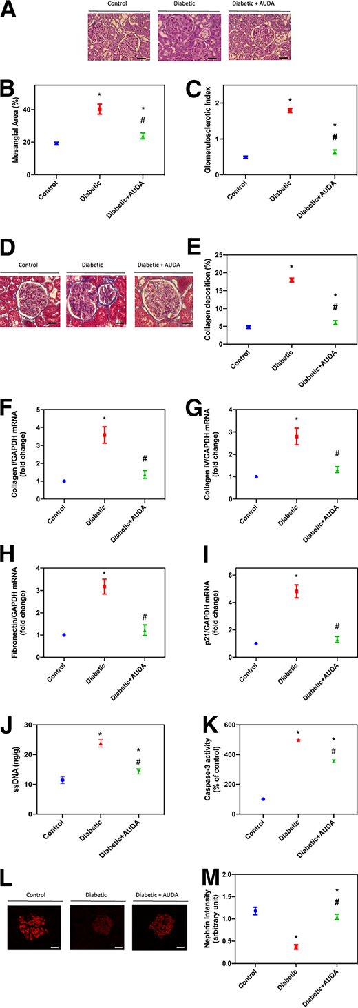 The effect of AUDA on kidney injury in T1D animal model. Control rats, untreated diabetic rats, and diabetic rats treated with AUDA are shown. The representative photomicrographs represent PAS reagent stain (A) to assess mesangial area (B) and GSI (C). MT staining (D) to evaluate collagen deposition (E) is shown. The corresponding histograms represent the intensity quantification per glomerular area measured by ImageJ software and using blinded observer evaluation of 15 randomly chosen glomeruli from 5 rat kidney cortices from each group. F: Relative mRNA levels of collagen I. G: Relative mRNA levels of collagen IV. H: Relative mRNA levels of fibronectin. I: Relative mRNA levels of p21. Apoptosis was assessed by ssDNA (J) and caspase-3 activity (K). Confocal photomicrographs for nephrin (L) to assess nephrin intensity (M) are shown. The values are the means ± SE. *P < 0.05 vs. controls; #P < 0.05 vs. untreated diabetic rats.