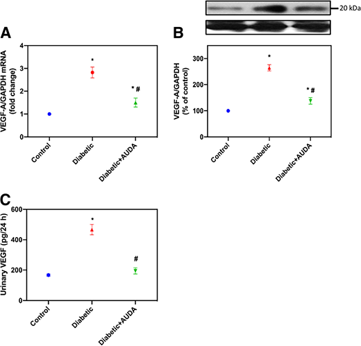 AUDA regulates VEFG mRNA, protein, and urine levels. A: Relative mRNA levels of VEGF-A. B: Histograms showing quantitation of VEGF/GAPDH. C: Urinary VEGF expressed in picograms per 24 h. All values are the means ± SE. *P < 0.05 vs. control; #P < 0.05 vs. untreated diabetic rats.