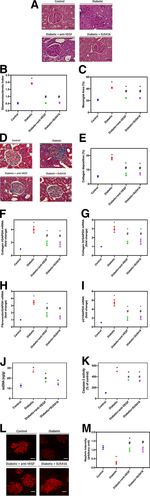 The effect of anti-VEGF and SU5416 on kidney injury in T1D rats. Control rats, diabetic untreated rats, diabetic rats treated with anti-VEGF neutralizing monoclonal antibody or with a selective tyrosine kinase inhibitor (SU5416) are shown. PAS reagent stains (A) to evaluate GSI (B) and mesangial area (C) are shown. MT staining (D) to assess collagen deposition (E) is shown. The intensity quantification per glomerular area was measured by ImageJ software using blinded observer evaluation of 25 randomly chosen glomeruli from 5 rat kidney cortices from each group. F: Relative mRNA levels of collagen I. G: Relative mRNA levels of collagen IV. H: Relative mRNA levels of fibronectin. I: Relative mRNA levels of p21. Apoptosis was assessed by ssDNA (J) and caspase-3 (K) activity. Confocal photomicrographs for nephrin (L) to assess nephrin intensity (M) are shown. The values are the means ± SE. *P < 0.05 vs. controls; #P < 0.05 vs. untreated diabetic rats.
