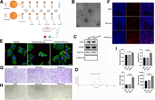 Identification of PDR-exo or MH-exo and their proangiogenic effects on HRVECs. A: A schematic showing the process of exosomes extracted from the vitreous humor of patients with PDR and patients with MH and the subsequent stimulation of endothelial cells and exosomal sequencing. B and D: PDR-exo and MH-exo were characterized with TEM (B) and nanoparticle tracking analysis (D). Scale bar = 200 nm. C: Western blot analysis of exosomal surface protein markers of PDR-exo and MH-exo. E: PKH26-labeled exosomes were taken up by HRVECs. Exosomes stained red, the cytoskeleton stained green, and the nuclei stained blue. Scale bar = 20 μm. F–I: Cell proliferation, migration, and tube formation ability of HRVECs after incubation with MH-exo or PDR-exo for 48 h. F: EdU assays were performed to assess cell proliferation ability. The number of EdU-positive cells labeled red was calculated in three random fields. Scale bar = 100 μm. G: Transwell assays were performed to assess cell migration ability. Scale bar = 100 μm. H: Matrigel tube formation assays were performed to assess cell tube formation ability. Scale bar = 100 μm. I: Statistical graphs of EdU, transwell, and tube formation assays. Error bars denote mean ± SD. *P < 0.05, ***P < 0.001, ****P < 0.0001.