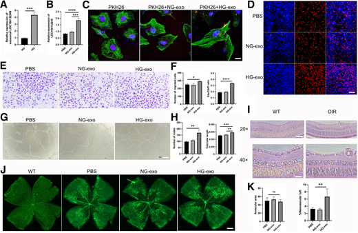 HG-exo promotes angiogenesis both in vitro and in vivo. A: Quantification of LOC100132249 in NG-exo and HG-exo. B: Expression level of cellular LOC100132249 after incubation with PBS, NG-exo, or HG-exo. C: Uptake of PKH26-labeled exosomes by HRVECs. Scale bar = 20 μm. D: EdU assays performed to assess cell proliferation. Scale bar = 100 μm. E: Transwell assays performed to assess cell migration. Scale bar = 100 μm. F: Quantification of EdU-positive cells and migrated cells. G: Matrigel tube formation assays performed to assess tube formation of HRVECs. Scale bar = 100 μm. H: Quantification of nodes and total tube length. I: Hematoxylin-eosin staining of retina in wild-type (WT) and OIR model mice. Scale bar = 50 μm. J: Whole-mount retinas stained with IB4 (n = 5). Scale bar = 100 μm. K: Quantification of avascular area and percentage of neovascular tuft. Error bars denote mean ± SD. *P < 0.05, **P < 0.01, ***P < 0.001, ****P < 0.0001.