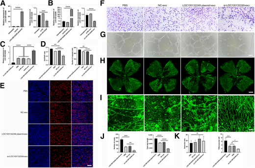 HG-exo–mediated angiogenesis is dependent on exosomal LOC100132249. A: Expression level of LOC100132249 after transfection of LOC100132249 plasmid or siRNA. B: Quantification of LOC100132249 in LOC100132249 plasmid-exo or si-LOC100132249-exo. C: Quantification of cellular LOC100132249 after stimulation with PBS, vector-exo, si-NC-exo, LOC100132249 plasmid-exo, or si-LOC100132249-exo. D: Quantification of EdU-positive cells and migrated cells. E: Proliferation of cells stimulated by LOC100132249 plasmid-exo or si-LOC100132249-exo. Scale bar = 100 μm. F: Migration of cells stimulated by LOC100132249 plasmid-exo or si-LOC100132249-exo. Scale bar = 100 μm. G: Tube formation of cells stimulated by LOC100132249 plasmid-exo or si-LOC100132249-exo. Scale bar = 100 μm. H: Whole-mount retinas stained with IB4 (n = 5). Scale bar = 100 μm. I: Detailed magnification of vessel leakage. Scale bar = 25 μm. J: Quantification of nodes and total tube length in tube formation assays. K: Quantification of avascular area and percentage of neovascular tuft. Error bars denote mean ± SD. *P < 0.05, **P < 0.01, ***P < 0.001, ****P < 0.0001.