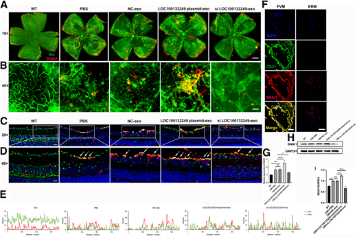 Exosomal LOC100132249 upregulates the expression of SNAI1, thus mediating microvascular dysfunction in vivo. A: Whole-mount retinas were stained with IB4 (green) and SNAI1 (red) (n = 4). Scale bar = 100 μm. B: Detailed magnification of vessel leakage and colocalization of IB4 and SNAI1. Scale bar = 25 μm. C: Frozen sections of retinas stained with CD31 and SNAI1. Green represents SNAI1, and red represents CD31 (n = 6). Scale bar = 50 μm. D: Detailed magnification of frozen sections and the location of CD31 and SNAI1 in retinas. The arrows point out the colocalization of CD31 and SNAI1. Scale bar = 25 μm. E: Quantification of the colocalization of CD31 and SNAI1 in each group. F: Immunofluorescence staining of FVMs and ERMs harvested from patients. Scale bar = 50 μm. G: RT-qPCR analysis of SNAI1 mRNA expression level of retinas from wild-type (WT) mice and OIR mice (n = 5). H: Western blot of SNAI1 protein expression in each group in vivo (n = 5). I: Quantification of SNAI1 protein levels in Western blot analysis. Error bars denote mean ± SD. *P < 0.05, ***P < 0.001, ****P < 0.0001.