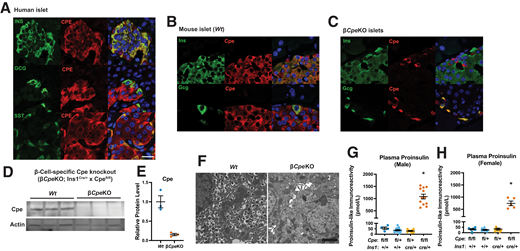 Elevated proinsulin levels in βCpeKO mice. A–C: Expression of CPE in human and mouse pancreatic islet cells was analyzed via immunostaining with antibodies against CPE, insulin (INS), glucagon (GCG), and somatostatin (SST). D and E: Cpe expression in βCpeKO mice was analyzed through immunoblotting (n = 3 and 3) with an antibody against Cpe. F: Representative electron micrographs of β-cells from Wt and βCpeKO mice. Scale bar = 2 μm (n = 3 and 3). G and H: 4-h fasting plasma proinsulin levels in βCpeKO and littermate male and female mice (n > 4 per genotype group per sex).