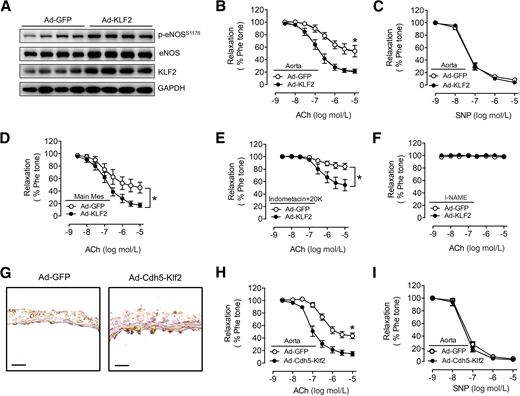 KLF2 overexpression improves endothelium-dependent relaxation through enhancing NO bioavailability in the aorta and main mesenteric arteries from db/db mice. A: Western blotting images show increased protein level of p-eNOSS1176, eNOS, and KLF2 in aortas from db/db mice injected with Ad-KLF2. Concentration-response curves showing ACh-induced endothelium-dependent relaxation in aortas from Ad-GFP– and Ad-KLF2–treated db/db mice (B) and SNP-induced endothelium-independent relaxation (C). *P < 0.05 vs. Ad-GFP, one-way ANOVA with the Tukey multiple comparison test. D: Concentration-response curves show ACh-induced endothelium-dependent relaxation in main mesenteric arteries from Ad-GFP– and Ad-KLF2–treated db/db mice. *P < 0.05 vs. Ad-GFP, one-way ANOVA with the Tukey multiple comparison test. ACh concentration-response curves after incubation with indomethacin plus 20 mmol/L KCl (E) and l-NAME (F) in main mesenteric arteries from Ad-GFP– and Ad-KLF2–treated db/db mice (n = 5). *P < 0.05 vs. Ad-GFP, one-way ANOVA with the Tukey multiple comparison test. G: Immunohistochemistry images showing increased KLF2 expression in aortic endothelium from db/db mice injected with Ad-Cdh5-Klf2. Scale bar: 50 μm. Concentration-response curves showing ACh-induced endothelium-dependent relaxation in aortas from db/db mice treated with Ad-GFP and Ad-Cdh5-Klf2 (H); and SNP-induced endothelium-independent relaxation (I). *P < 0.05 vs. Ad-GFP, one-way ANOVA with the Tukey multiple comparison test. The results are means ± SEΜ of five to six experiments.