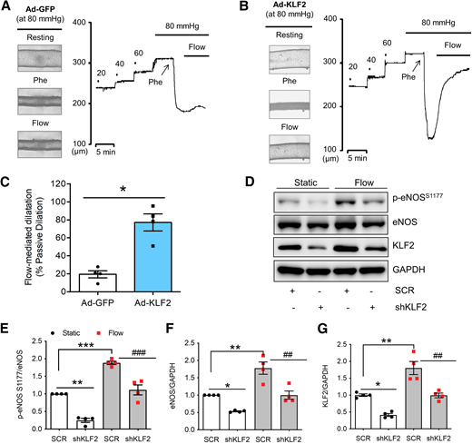 KLF2 overexpression improves FMD in second-order mesenteric arteries from db/db mice. Representative traces and images of FMD in small mesenteric arteries from db/db mice with Ad-GFP (A) and Ad-KLF2 (B) treatment. C: Summarized data showing FMD was improved by Ad-KLF2 treatment. *P < 0.05 vs. Ad-GFP, unpaired two-tailed t test. Representative Western blotting images (D) and summarized data (E–G) showing KLF2 is required for flow-induced elevation of p-eNOS S1177 level and eNOS expression in human aortic ECs. *P < 0.05, **P < 0.01, ***P < 0.001 vs. SCR at static; ##P < 0.01, ###P < 0.001 vs. SCR at flow, two-way ANOVA with the Tukey multiple comparison test.