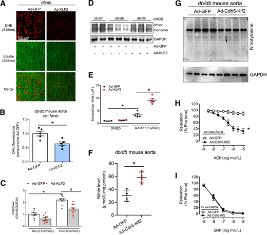 Reduced oxidative stress and increased eNOS dimerization in aortas from db/db mice treated with Ad-KLF2. Representative DHE fluorescence images (A) and summarized data of DHE fluorescent intensity (B) indicative of en face ROS levels in aortas from Ad-GFP– and Ad-KLF2–treated db/db mice. *P < 0.05 vs. Ad-GFP, unpaired two-tailed t test. (C) Relative chloromethyl–2′,7′-dichlorodihydrofluorescein diacetate (CM-H2DCFDA) fluorescent intensity indicative of ROS levels in HUVECs exposed to normal glucose (NG, 5.5 mmol/L) and HG (30 mmol/L) and followed by Ad-GFP and Ad-KLF2 treatment. *P < 0.05 vs. Ad-GFP at NG, #P < 0.05 vs. Ad-GFP at HG, two-way ANOVA with the Tukey multiple comparison test. D: The level of eNOS dimer and eNOS monomer in aortas from db/m+ and db/db mice treated with Ad-GFP or Ad-KLF2. E: Ad-KLF2 transduction in HUVECs for 24 h, followed by A23187 (1 μmol/L) stimulation for 16 h, increased NO production indicated by extracellular nitrite levels. *P < 0.05 vs. DMSO, #P < 0.05 vs. A23187, two-way ANOVA with the Tukey multiple comparison test. F: Increased nitrite level in db/db mouse aortas transduced with Ad-Cdh5-Klf2 vector. *P < 0.05 vs. Ad-GFP, unpaired two-tailed t test. G: Western blotting data showing decreased protein nitrotyrosine level by Ad-Cdh5-Klf2 transduction in db/db mouse aortas. H: Ad-Cdh5-Klf2 transduction ex vivo to aortic rings isolated from db/db mice for 16 h improved EDR in response to ACh. *P < 0.05 vs. Ad-GFP, one-way ANOVA with the Tukey multiple comparison test. I: Ad-Cdh5-Klf2 transduction ex vivo did not affect endothelium-independent relaxation in aortic rings isolated from db/db mice in response to sodium nitroprusside.