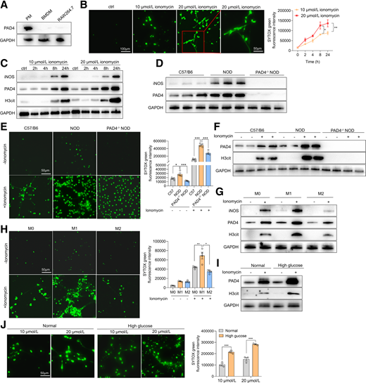 PAD4 mediates M1 polarization of peritoneal macrophages and MET formation. A: PAD4 protein expression in PMs, BMDMs, and Raw264.7 (n = 3). B: Levels of MET formation in PMs after stimulation with 10 and 20 μmol/L ionomycin for 8 h (n = 3). C: Protein expression levels of iNOS, PAD4, and H3cit in PMs after stimulation with 10 and 20 μmol/L ionomycin over a period of 0–24 h (n = 3). D: Protein expression levels of iNOS and PAD4 in PMs derived from C57/B6, NOD, and PAD4−/− NOD mice (n = 3). E: Levels of MET formation in PMs from C57/B6, NOD, and PAD4−/− NOD mice after stimulation with 20 μmol/L ionomycin for 8 h (n = 4). F: Protein expression levels of PAD4 and H3cit in PMs from C57/B6, NOD, and PAD4−/− NOD mice after stimulation with 20 μmol/L ionomycin for 8 h (n = 3). G: Protein expression levels of iNOS, PAD4, and H3cit in M0, M1, and M2 polarized PMs after stimulation with 20 μmol/L ionomycin for 8 h (n = 3). H: Levels of MET formation in M0, M1, and M2 polarized PMs after stimulation with 20 μmol/L ionomycin for 8 h (n = 3–4). I: Levels of MET formation in normal and high-glucose environments with 10 and 20 μmol/L for 8 h (n = 3). J: Protein expression levels of PAD4 and H3cit in PMs after stimulation with 20 μmol/L ionomycin for 8 h under normal and high-glucose environments (n = 3). All data presented as mean ± SEM. B, E, H, and J: Statistical significance assessed by two- (B) or one-way ANOVA (E and H) or Student t test (J). *P < 0.05, **P < 0.01, ***P < 0.001.