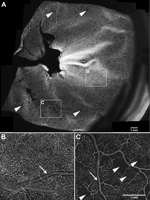 Endothelial cells in retinal whole mount. A: Example of a retinal whole mount stained with UEA revealing endothelial cells (optic disc and sclera have been removed). B and C: Zoomed-in images of boxes shown in A. Capillary-free regions can be seen in the vicinity of arteries (arrow in B and C), which is normal. In contrast, localized small capillary-free patches in the periphery (arrowheads in A and C) are indicative of retinal vasculature pathology. FAZ, foveal avascular zone. Scale bar = 1 mm.