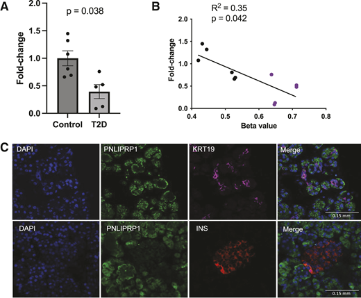 Expression of PNLIPRP1 at the RNA and protein levels. A: RNA expression of PNLIPRP1 in a subset of 11 individuals (five with T2D vs. six controls without diabetes), matched for age, sex, and BMI. t tests were performed to test for differences between T2D and nondiabetic samples for the PNLIPRP1 gene. Error bars represent SEs. B: Correlation between the cg15549216 probe and RNA expression of the PNLIPRP1 gene determined by qPCR and compared with housekeeping gene RPLP0. Dots shown in black are donors without diabetes, and those in purple are individuals with T2D. C: Immunofluorescence of healthy human whole-pancreas tissue samples stained for PNLIPRP1 and KRT19, a ductal marker (top), and insulin (INS; a marker for pancreatic islets). Nuclei were stained with DAPI.