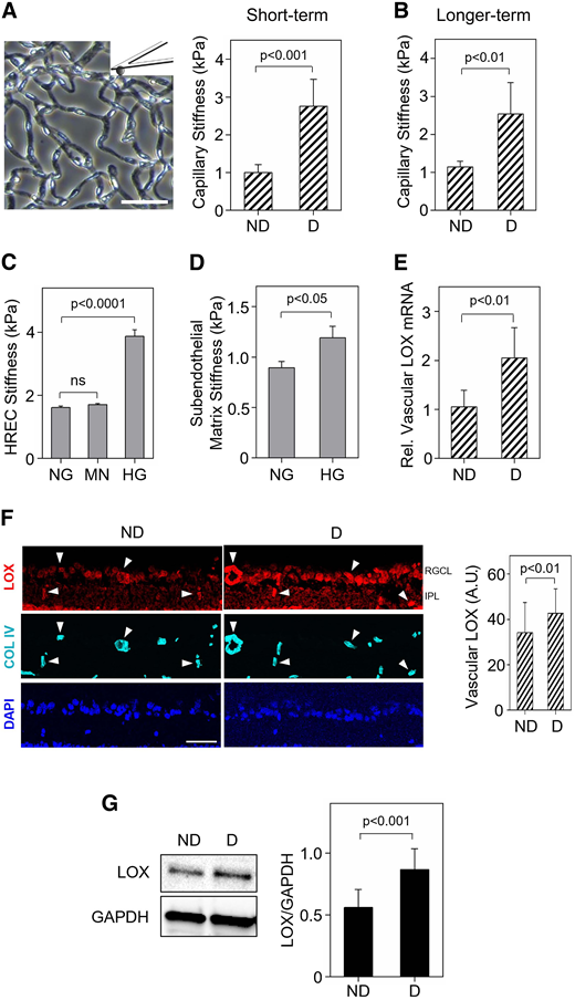 Retinal capillaries become stiffer in diabetes. A and B: Stiffness of retinal capillaries isolated from ND and D mice (representative image) was measured using a biological grade AFM (n = 6/group). Quantitative analysis of force-indentation curves from ≥12 locations on the capillary network revealed an ∼2.5-fold increase (P < 0.01) in stiffness following both short-term (10 weeks’ duration) (A) and longer-term (20–30 weeks’ duration) (B) diabetes. Scale bar: 50 µm. C and D: Quantitative analysis of AFM force-indentation curves from multiple (n ≥ 20) cultured HRECs or multiple locations (n ≥ 20) on the unfixed decellularized subendothelial matrix revealed that 10-day HG treatment (30 mmol/L) leads to a significant increase in both HREC (C) and matrix stiffness (D). E: RT-qPCR analysis of freshly isolated mouse retinal vessels (n = 6–7/group) revealed a twofold increase (P < 0.001) in retinal vascular LOX mRNA in short-term (10 weeks’ duration) D mice. F: Representative fluorescent images show mouse retinal sections from ND and short-term (10 weeks’ duration) D mice immunolabeled with anti-LOX, anti-collagen (Col) IV (vascular basement membrane), and DAPI (nucleus). LOX intensity analysis from multiple (n ≥ 160) vessels/group in the retinal ganglion cell layer, the inner plexiform layer, and the inner plexiform layer/inner nuclear layer boundary indicated that diabetes leads to a significant increase in LOX protein expression in retinal vessels (arrowhead). A.U., arbitrary units. Scale bar, 50 µm. G: Western blot analysis of whole retinas from mice (n = 6–8 mice/group) revealed a 1.5-fold increase (P < 0.001) in retinal LOX protein levels in longer-term D mice. Bars indicate mean ± SD (in vivo data) or mean ± SEM (in vitro data).