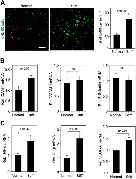 Retinal capillary stiffening alone can enhance leukocyte-EC adhesion. A: Representative fluorescent images of adherent (neutrophil-like) dHL-60 cells and subsequent cell count (n ≥ 6 images/condition from three replicates) revealed a twofold greater (P < 0.001) dHL-60 cell adhesion to HRECs grown on stiff (2.5 kPa) synthetic matrices (for 24 h) than those grown on normal matrices (1 kPa). Scale bar: 200 µm. B: RT-qPCR analysis of HRECs grown on normal (1 kPa) or stiff (2.5 kPa) synthetic matrices for 18 h revealed that matrix stiffening preferentially increases the mRNA levels of ICAM-1 (by 1.6-fold; P < 0.05) but not VCAM-1 or E-selectin. C: RT-qPCR analysis of HRECs grown on normal (1 kPa) or stiff (2.5 kPa) synthetic matrices (n = 3/condition) for 18 h revealed that matrix stiffening increases the mRNA levels of TNF-α (by 1.8-fold; P < 0.05), IL-1β (by 2.3-fold; P < 0.01), and VEGF-A (by 1.4-fold; P < 0.01). Bars indicate mean ± SEM.
